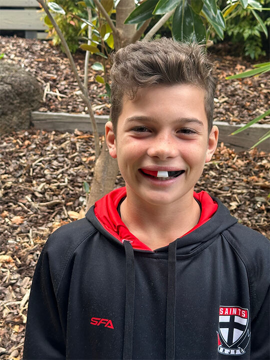 Smileflex® Junior Sports Mouthguard