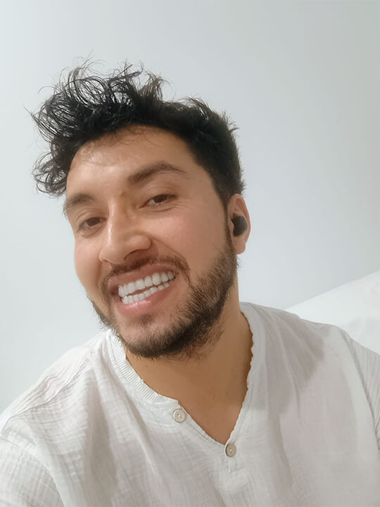 Smileflex® Pro Custom Whitening Kit