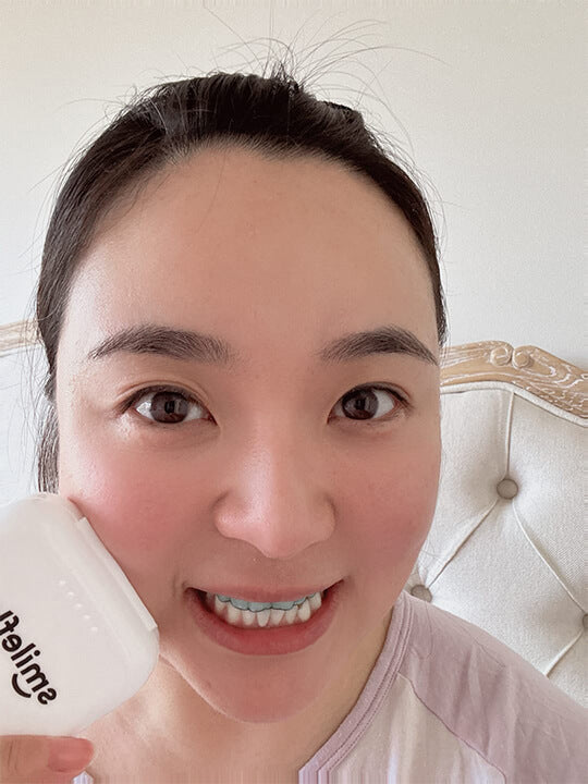 Smileflex® Night Retainer Max™