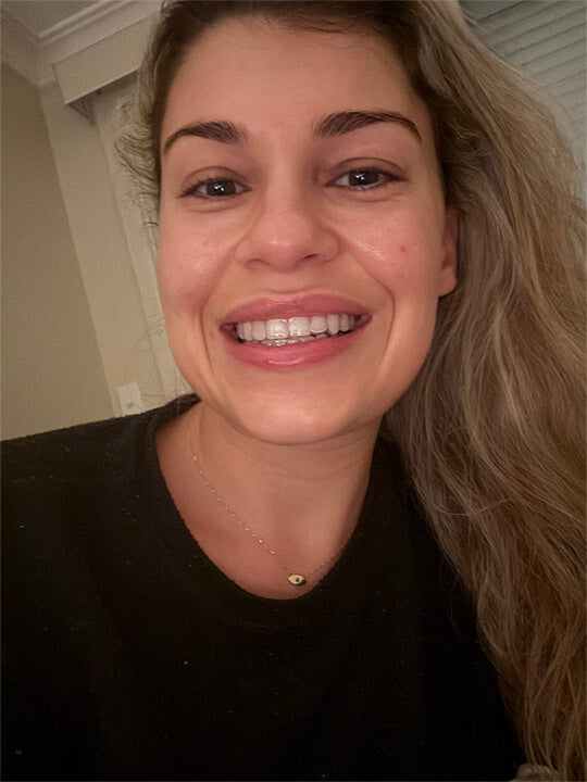 Smileflex® Night Retainer Max™