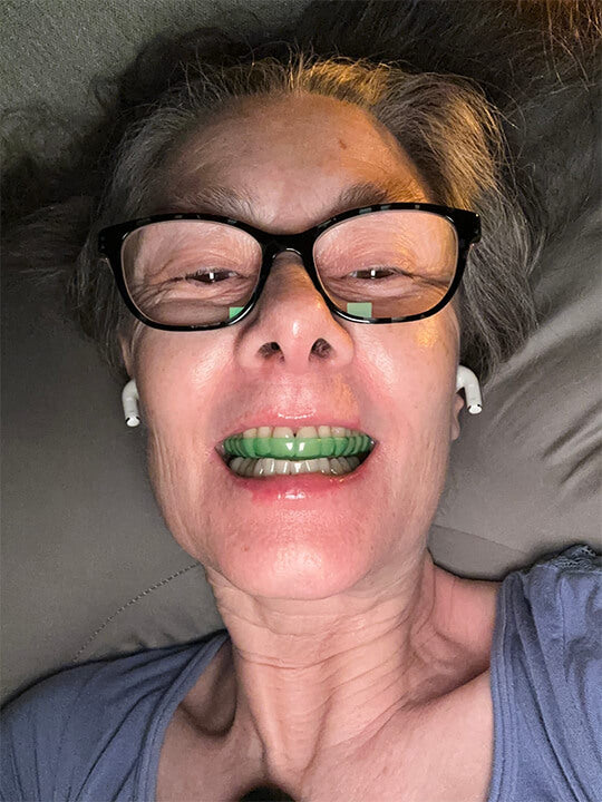 Smileflex® Night Guard+