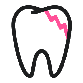 Unexplained tooth damage
